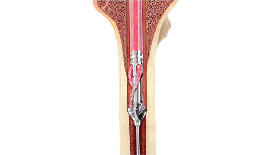 depuy-ria-2